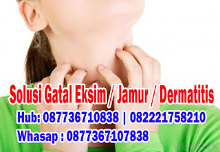 Gambar Cara Alami Menyembuhkan Kulit Gatal Bersisik