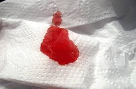 Gambar OBAT BUAT BAB YANG BERDARAH SAKIT