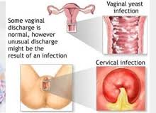 Gambar Makanan Pencegah Kanker Serviks