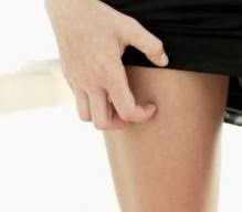 Gambar Obat Untuk Gatal Penyakit Eksim Kering Parah