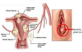 Gambar Toko Obat Kanker Kanker Serviks Di Kota Bandung