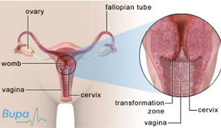 Gambar Apotik Yang Menjual Obat Kanker Serviks