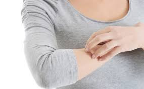 Gambar Obat Ampuh Untuk Gatal Eksim Kering