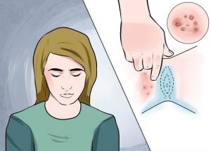 Foto Ciri-ciri Sakit Daging Tumbuh Di Kelamin Dan Cara Mengobatinya