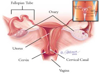 Foto Bagaimana Cara Mengobati Kanker Serviks